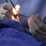 mutirao-hospitais-mc_abr_05072025-16