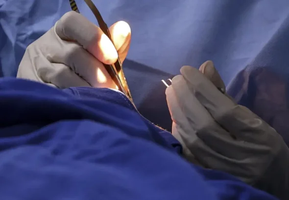 mutirao-hospitais-mc_abr_05072025-16