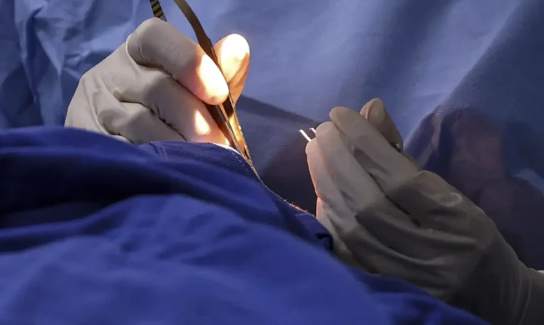 mutirao-hospitais-mc_abr_05072025-16